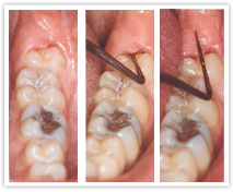 Procedures - Oral Surgery